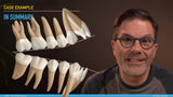 Treating anterior open bites with clear aligners (6 CE) The C.L.E.A.R. Institute