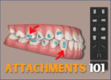 Attachments 101 (1.5 CE)
