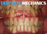 Deep bite mechanics (3 CE) The C.L.E.A.R. Institute