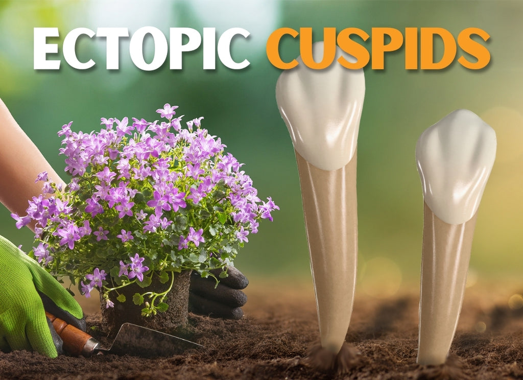 Ectopic cuspids (4 CE)