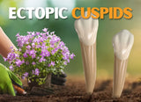 Ectopic cuspids (4 CE) The C.L.E.A.R. Institute