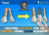 Creating Space for an Implant with Clear Aligners ON-DEMAND WEBINAR (1 CE) The C.L.E.A.R. Institute