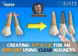 M.O.C.A. 101 - Clear Aligner Principles (45 CE)