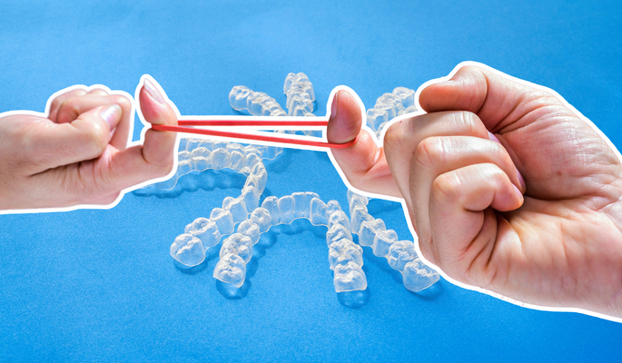 Using clear aligners and elastics: a great combination!