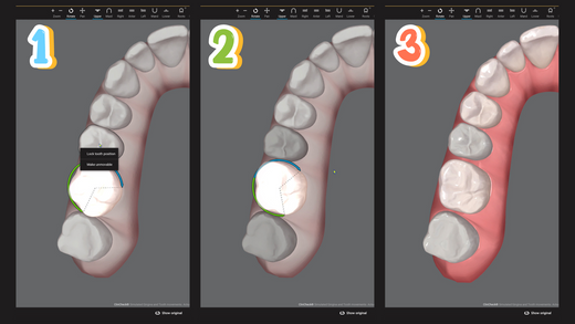 The Underestimated Power of Molar Derotation in Space Management