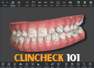 ClinCheck® 101: complete tutorial