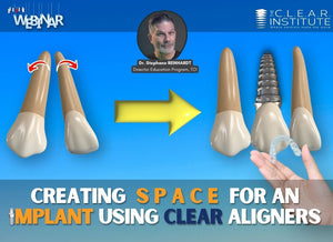 Creating Space for an Implant with Clear Aligners (ON-DEMAND WEBINAR)